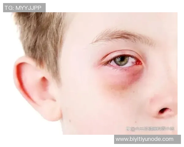 小卡解释鼻子出血原因只是轻微划伤并遭遇眼部意外碰撞 小卡解释鼻子出血原因只是轻微划伤并遭遇眼部意外碰撞